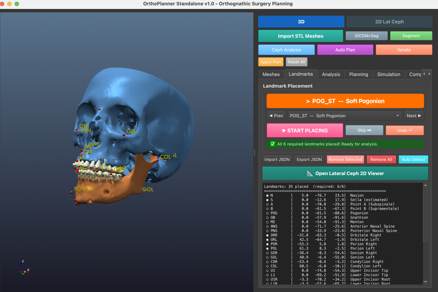 OrthoPlanner — AI-assisted 3D orthognathic planning software developed by Prof. Basa
